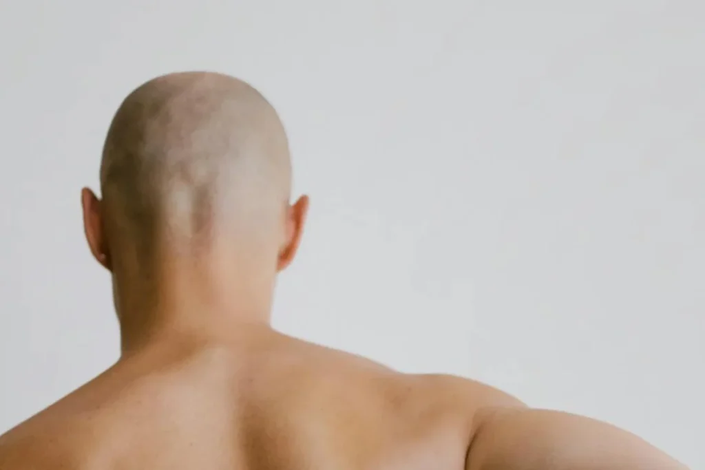 back bald head man 